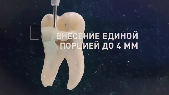 SDR - рациональный заменитель дентина