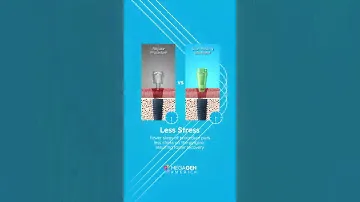 𝗦𝗰𝗮𝗻 𝗛𝗲𝗮𝗹𝗶𝗻𝗴 𝗔𝗯𝘂𝘁𝗺𝗲𝗻𝘁 - Healing & Scan with ONE abutment